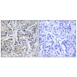 Immunohistochemistry - Anti-Centromeric Protein A Antibody (B0858) - Antibodies.com