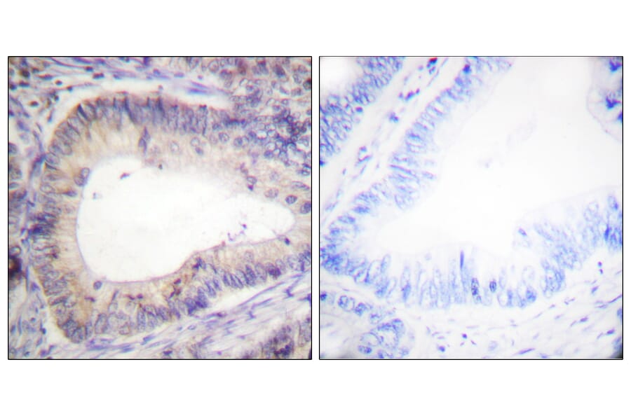 Immunohistochemistry - Anti-BCL-2 (phospho Thr69) Antibody (A0774) - Antibodies.com
