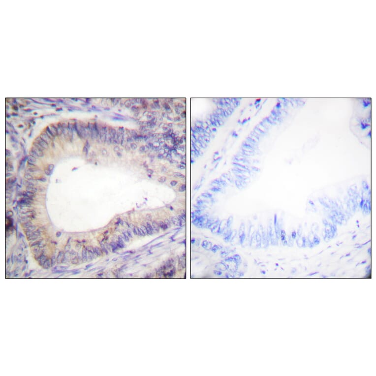 Immunohistochemistry - Anti-BCL-2 (phospho Thr69) Antibody (A0774) - Antibodies.com