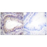 Immunohistochemistry - Anti-BCL-2 (phospho Thr69) Antibody (A0774) - Antibodies.com