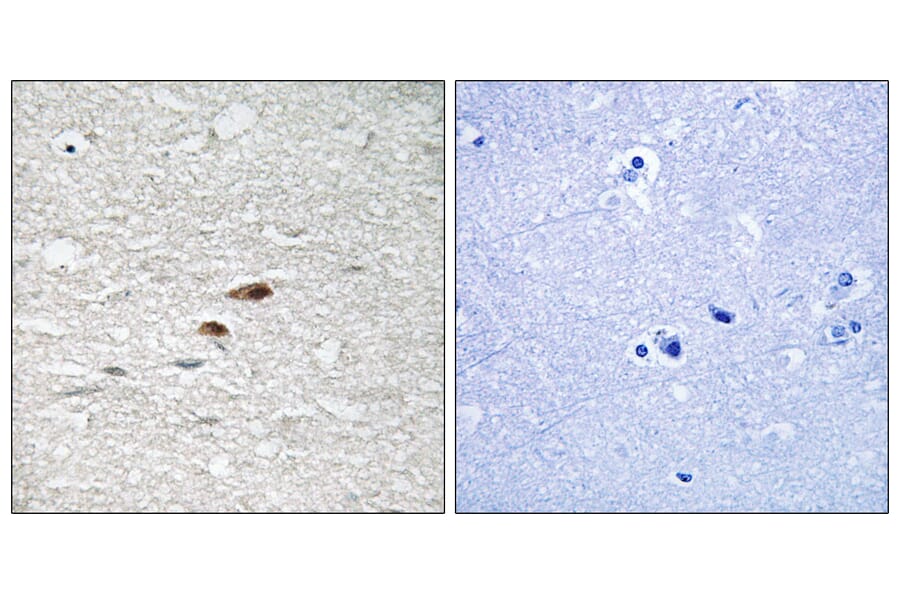 Immunohistochemistry - Anti-APC (phospho Ser2054) Antibody (A0818) - Antibodies.com