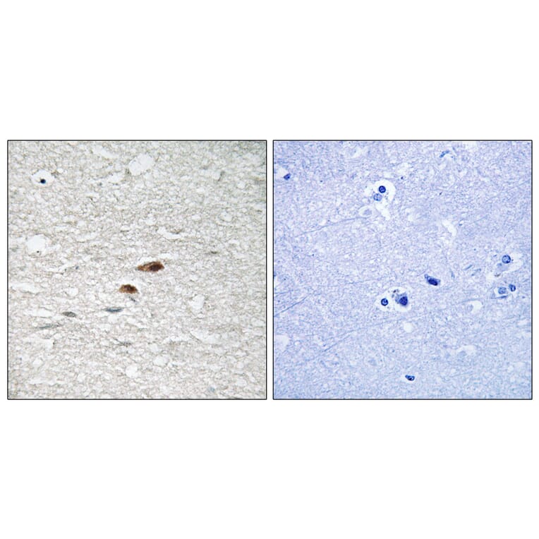 Immunohistochemistry - Anti-APC (phospho Ser2054) Antibody (A0818) - Antibodies.com