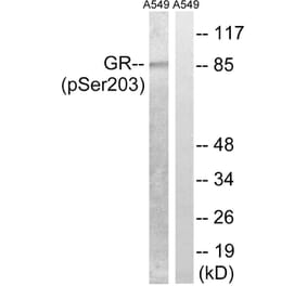 Western Blot - Anti-GR (phospho Ser203) Antibody (A8038) - Antibodies.com