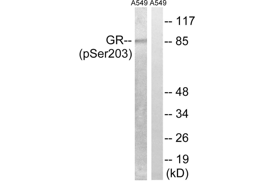 Western Blot - Anti-GR (phospho Ser203) Antibody (A8038) - Antibodies.com