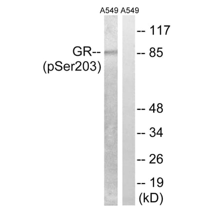 Western Blot - Anti-GR (phospho Ser203) Antibody (A8038) - Antibodies.com