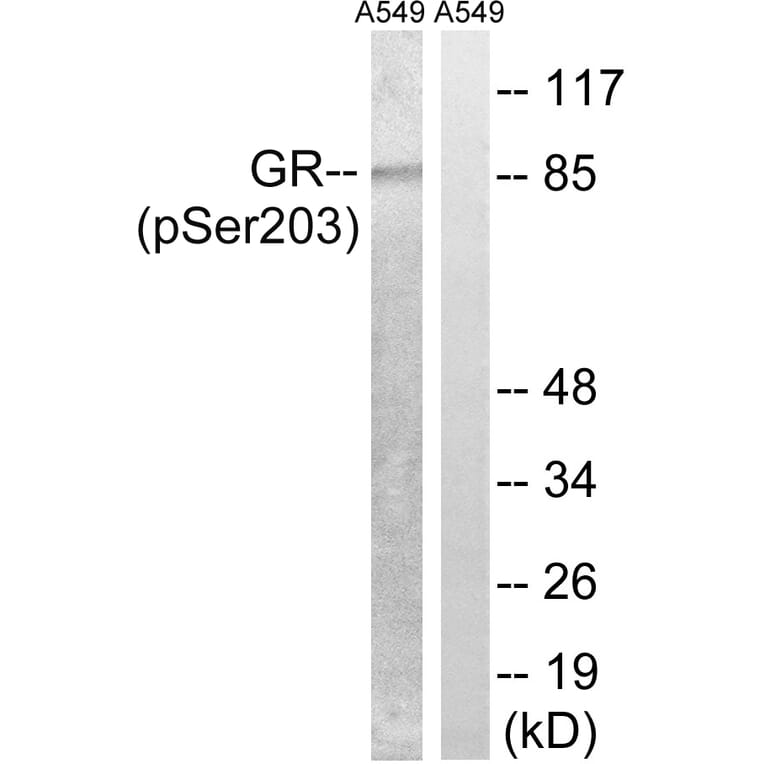 Western Blot - Anti-GR (phospho Ser203) Antibody (A8038) - Antibodies.com
