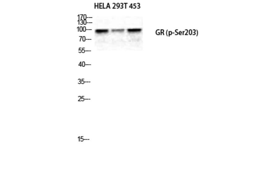 Western Blot - Anti-GR (phospho Ser203) Antibody (A8038) - Antibodies.com