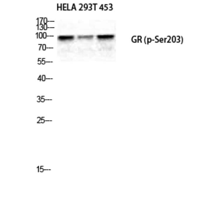 Western Blot - Anti-GR (phospho Ser203) Antibody (A8038) - Antibodies.com
