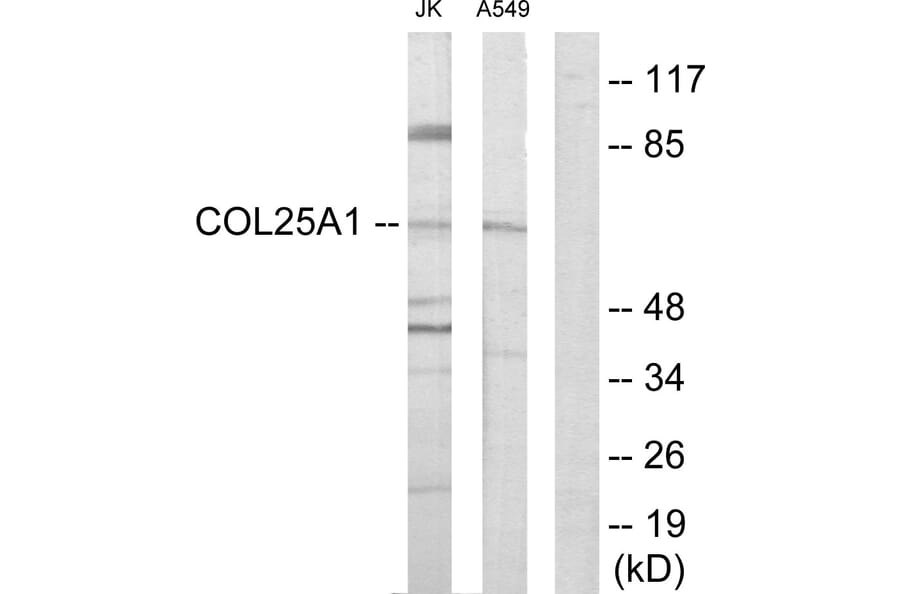 Western Blot - Anti-Collagen XXV alpha1 Antibody (C12227) - Antibodies.com