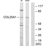 Western Blot - Anti-Collagen XXV alpha1 Antibody (C12227) - Antibodies.com