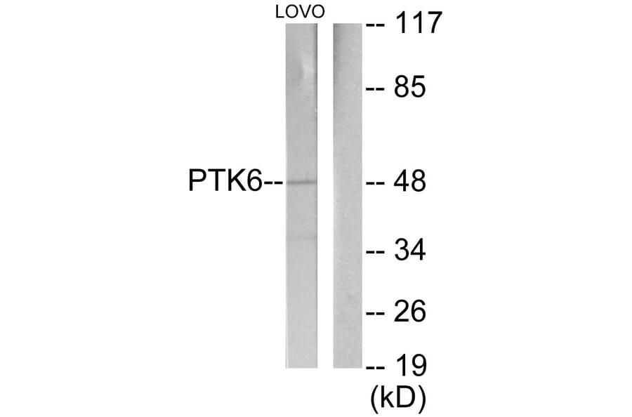 Western Blot - Anti-Breast Tumor Kinase Antibody (C11007) - Antibodies.com