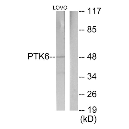 Western Blot - Anti-Breast Tumor Kinase Antibody (C11007) - Antibodies.com