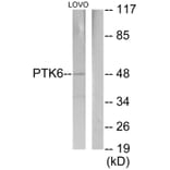 Western Blot - Anti-Breast Tumor Kinase Antibody (C11007) - Antibodies.com