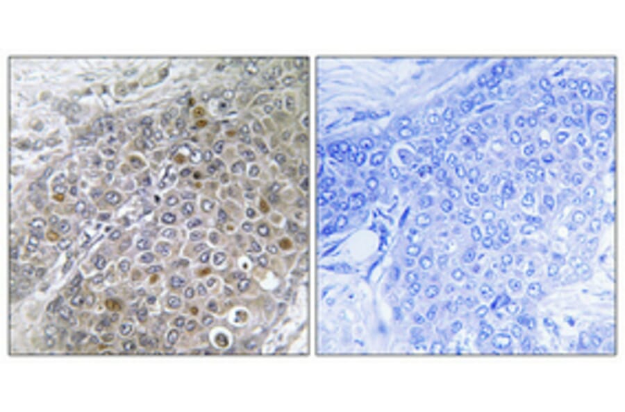 Immunohistochemistry - Anti-Breast Tumor Kinase Antibody (C11007) - Antibodies.com