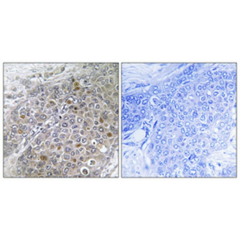 Immunohistochemistry - Anti-Breast Tumor Kinase Antibody (C11007) - Antibodies.com