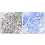 Immunohistochemistry - Anti-Breast Tumor Kinase Antibody (C11007) - Antibodies.com