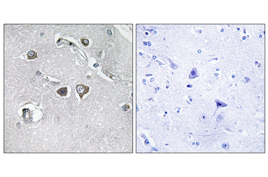Immunohistochemistry - Anti-Collagen XI alpha2 Antibody (C12215) - Antibodies.com