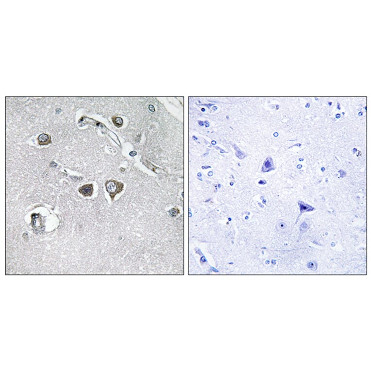 Immunohistochemistry - Anti-Collagen XI alpha2 Antibody (C12215) - Antibodies.com