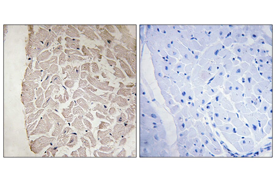 Immunohistochemistry - Anti-Collagen VI alpha1 Antibody (C12204) - Antibodies.com