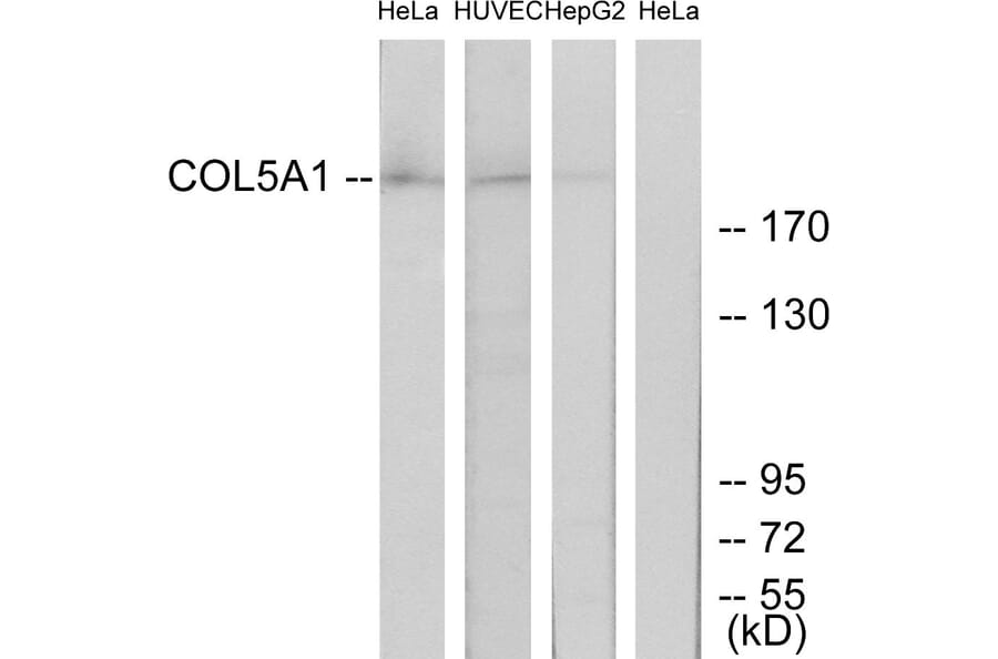 Western Blot - Anti-Collagen V alpha1 Antibody (C12201) - Antibodies.com