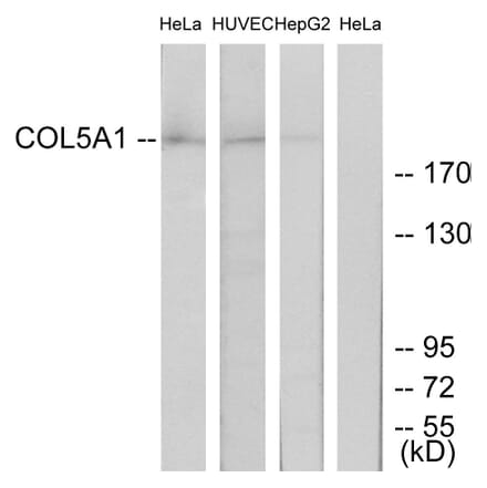 Western Blot - Anti-Collagen V alpha1 Antibody (C12201) - Antibodies.com