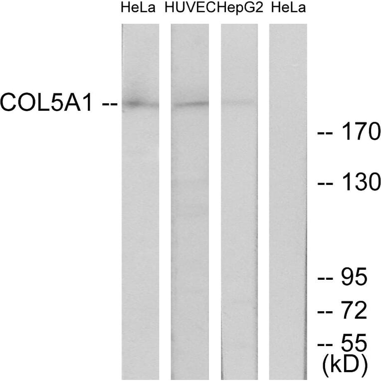 Western Blot - Anti-Collagen V alpha1 Antibody (C12201) - Antibodies.com