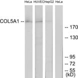 Western Blot - Anti-Collagen V alpha1 Antibody (C12201) - Antibodies.com