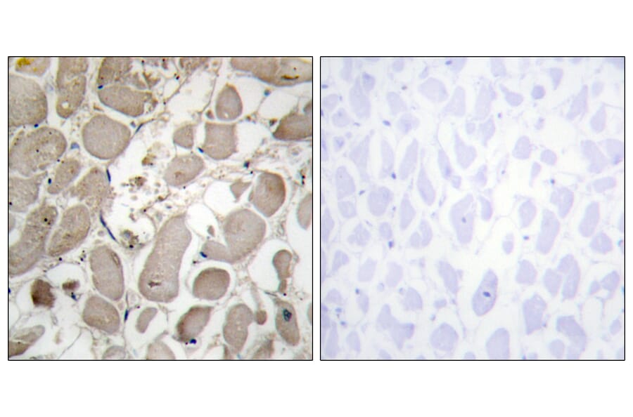 Immunohistochemistry - Anti-Collagen V alpha1 Antibody (C12201) - Antibodies.com