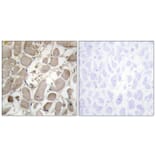 Immunohistochemistry - Anti-Collagen V alpha1 Antibody (C12201) - Antibodies.com