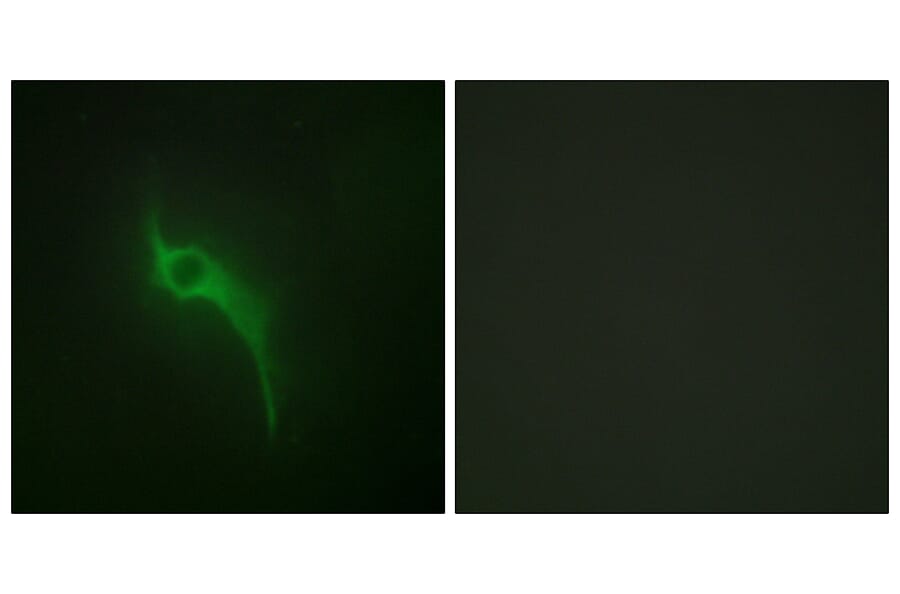 Immunofluorescence - Anti-Collagen V alpha1 Antibody (C12201) - Antibodies.com