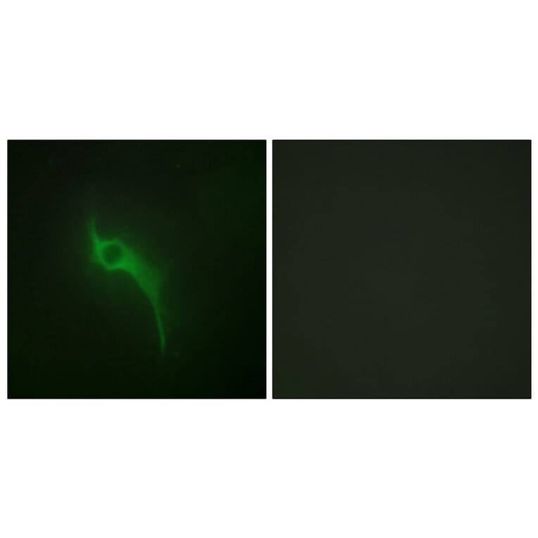 Immunofluorescence - Anti-Collagen V alpha1 Antibody (C12201) - Antibodies.com