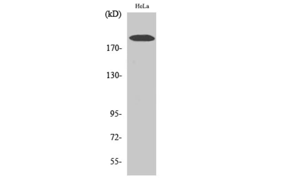 Western Blot - Anti-Collagen V alpha1 Antibody (C12201) - Antibodies.com
