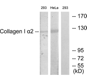 Western Blot - Anti-Collagen I alpha2 Antibody (C12195) - Antibodies.com
