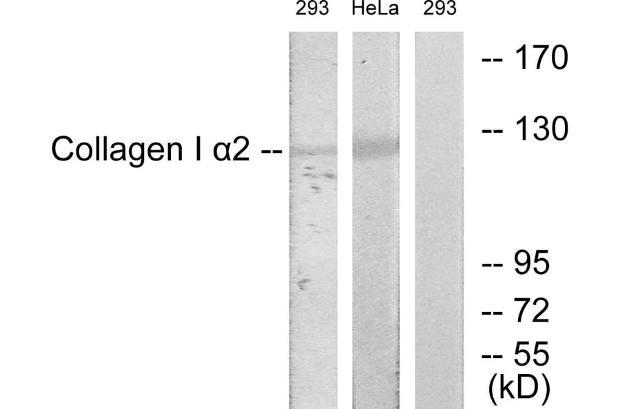 Western Blot - Anti-Collagen I alpha2 Antibody (C12195) - Antibodies.com