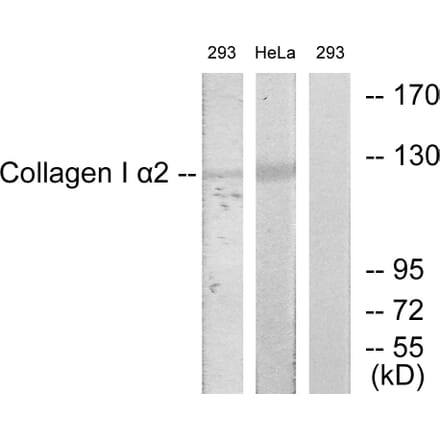 Western Blot - Anti-Collagen I alpha2 Antibody (C12195) - Antibodies.com