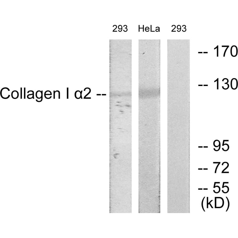 Western Blot - Anti-Collagen I alpha2 Antibody (C12195) - Antibodies.com