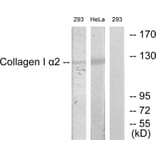 Western Blot - Anti-Collagen I alpha2 Antibody (C12195) - Antibodies.com