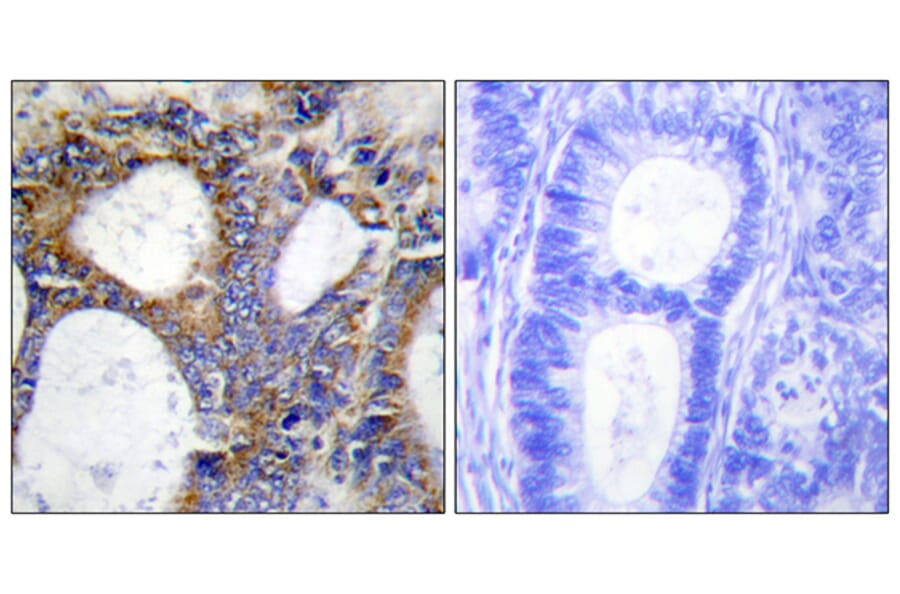 Immunohistochemistry - Anti-Collagen I alpha2 Antibody (C12195) - Antibodies.com