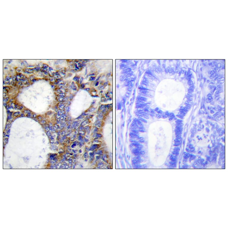 Immunohistochemistry - Anti-Collagen I alpha2 Antibody (C12195) - Antibodies.com