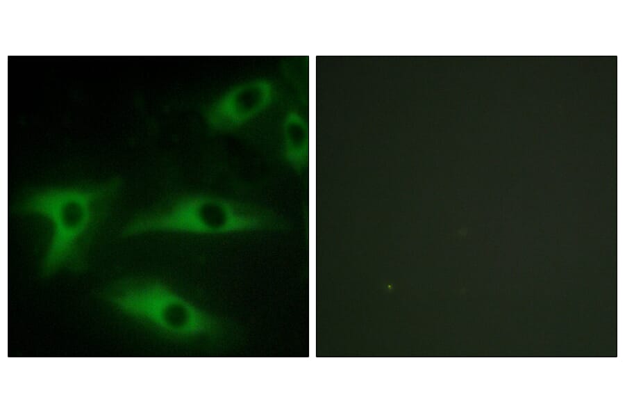 Immunofluorescence - Anti-Collagen I alpha2 Antibody (C12195) - Antibodies.com