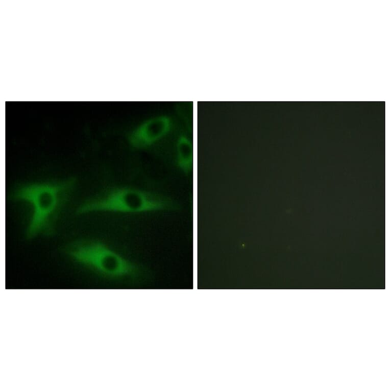 Immunofluorescence - Anti-Collagen I alpha2 Antibody (C12195) - Antibodies.com