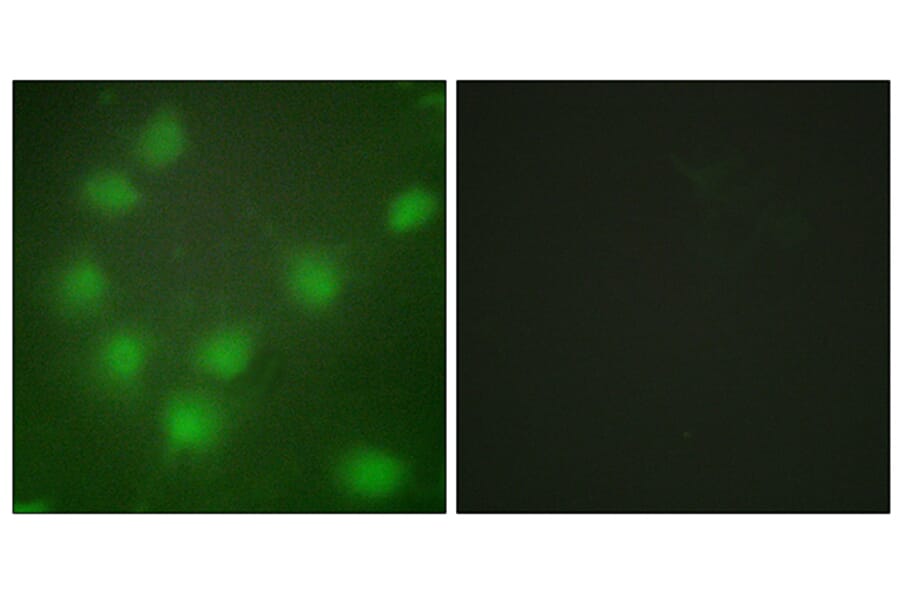 Immunofluorescence - Anti-HOXA11 + HOXD11 Antibody (C16289) - Antibodies.com