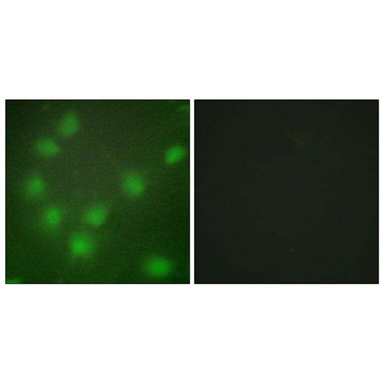 Immunofluorescence - Anti-HOXA11 + HOXD11 Antibody (C16289) - Antibodies.com