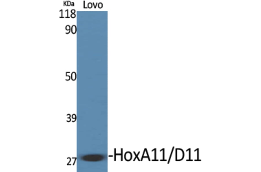 Western Blot - Anti-HOXA11 + HOXD11 Antibody (C16289) - Antibodies.com
