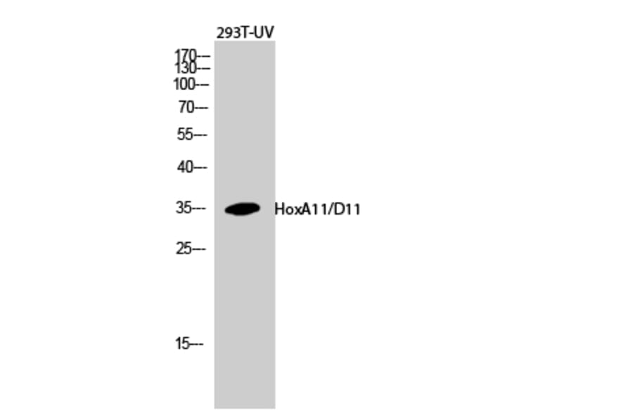Western Blot - Anti-HOXA11 + HOXD11 Antibody (C16289) - Antibodies.com