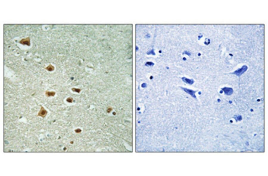 Immunohistochemistry - Anti-HOXA11 + HOXD11 Antibody (C16289) - Antibodies.com