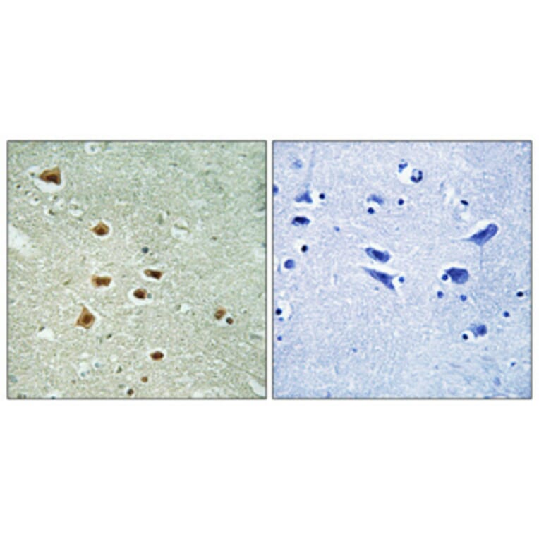 Immunohistochemistry - Anti-HOXA11 + HOXD11 Antibody (C16289) - Antibodies.com