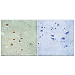 Immunohistochemistry - Anti-HOXA11 + HOXD11 Antibody (C16289) - Antibodies.com