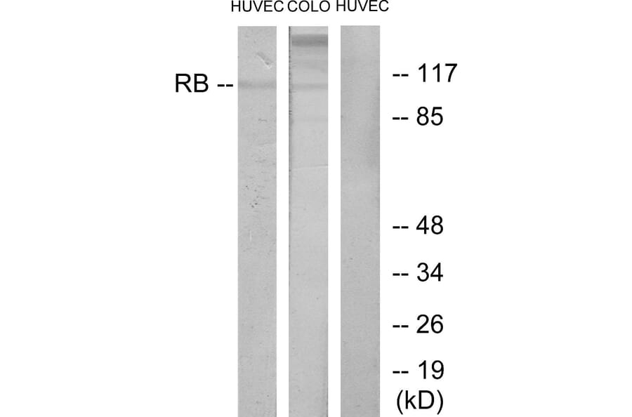 Western Blot - Anti-Retinoblastoma Antibody (B7209) - Antibodies.com