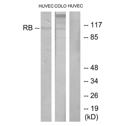 Western Blot - Anti-Retinoblastoma Antibody (B7209) - Antibodies.com